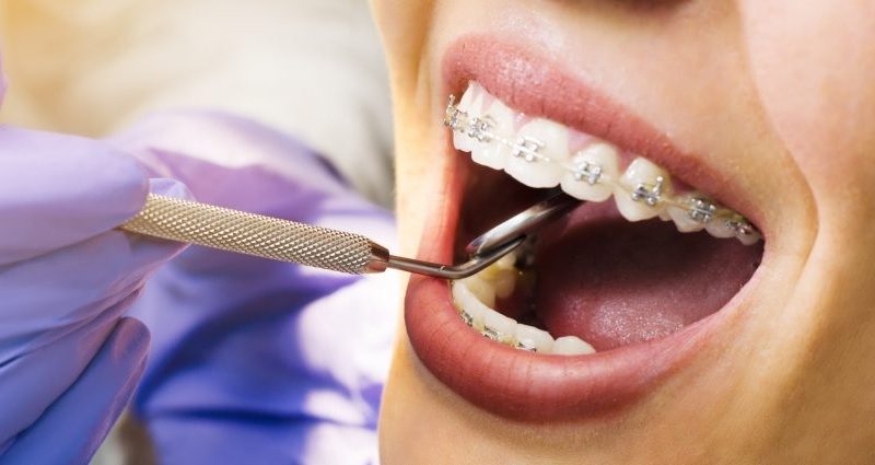 How Orthodontics Can Help Improve Your Dental Health