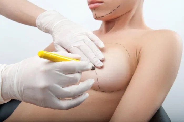 Types Of Breast Surgery Procedures
