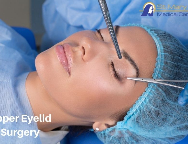 How to Get a Rejuvenated Look with an Eyelid Surgery?