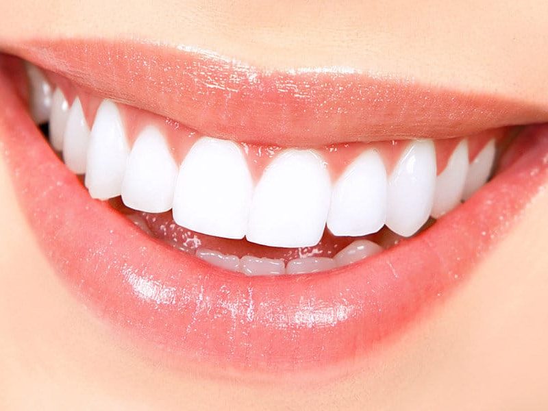 What to Know to Maintain Healthy and White Teeth?