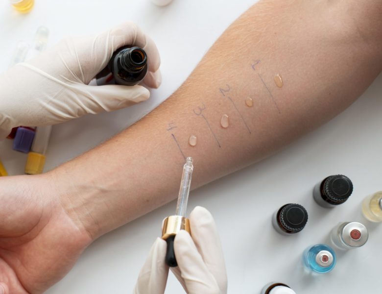 A Guide to Allergy Tests and When You Need Them