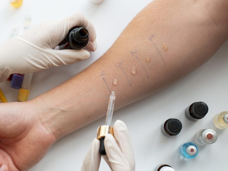 A Guide to Allergy Tests and When You Need Them