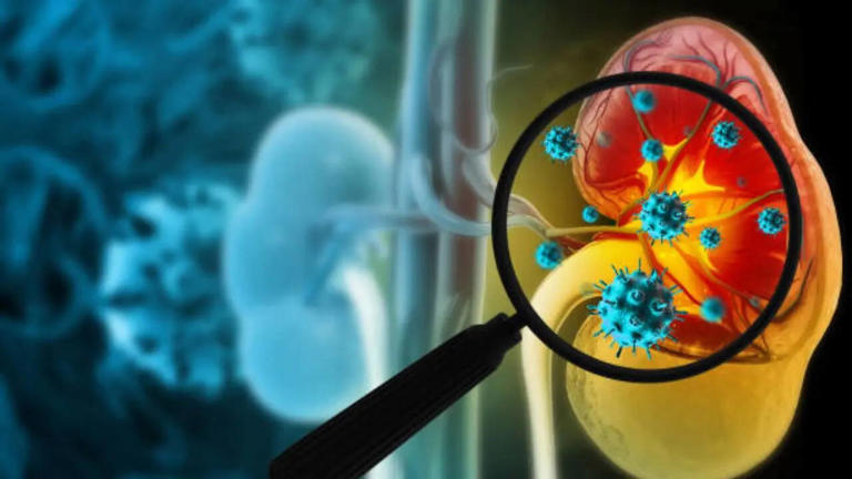 lThe Silent Indicators: 7 Early Warning Signs of Kidney Disease You Shouldn’t Ignore
