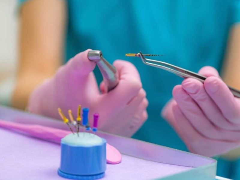 Things To Expect When Seeing An Endodontist For Tooth Pain