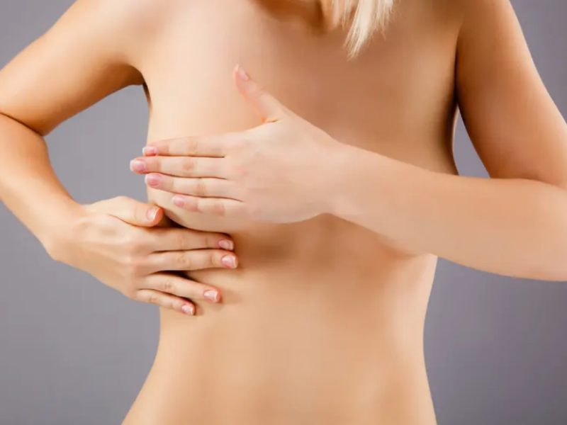 Understanding Orange Peel Skin in Breast Cancer