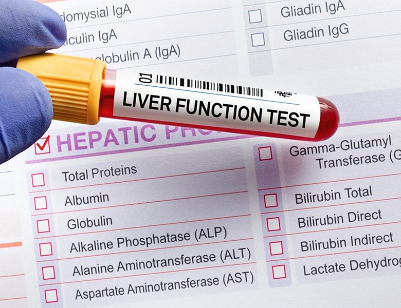 Lipid Profile Test: Purpose and Procedure