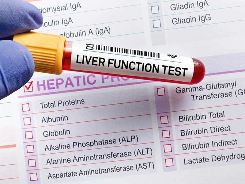 Lipid Profile Test: Purpose and Procedure