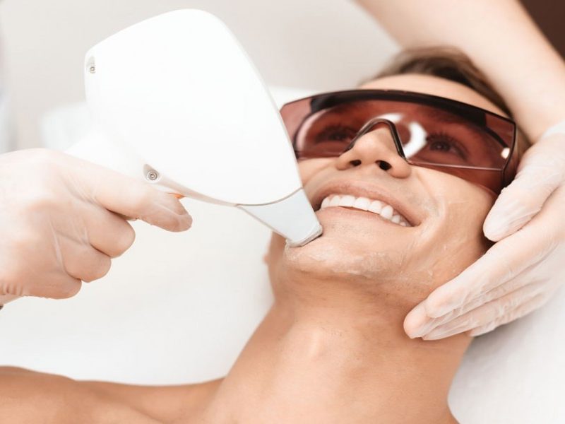 Why First-Time Clients Are Choosing Starter Packages Over Traditional Hair Removal